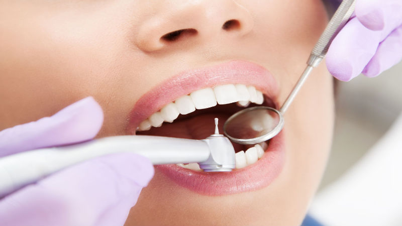 Types Of Restorative Dentistry In Birmingham MI