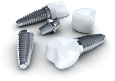 Three Dental implant