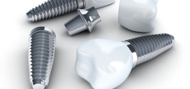 Three Dental implant