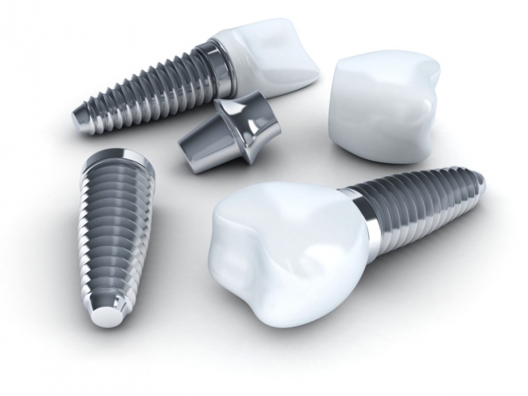 Three Dental implant